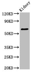 Western Blot Positive WB detected in: Mouse kidney tissue All lanes: GRK5 antibody at 3.4ug/ml Secondary Goat polyclonal to rabbit IgG at 1/50000 dilution Predicted band size: 68 kDa Observed band size: 68 kDa