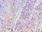 Immunohistochemistry of paraffin-embedded human tonsil tissue using CSB-PA009927ESR1HU at dilution of 1:100