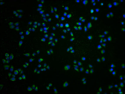 Immunofluorescence staining of Hela cells with CSB-PA009929LA01HU at 1:100, counter-stained with DAPI. The cells were fixed in 4% formaldehyde and blocked in 10% normal Goat Serum. The cells were then incubated with the antibody overnight at 4°C....
