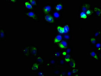 Immunofluorescence staining of Hela cells with CSB-PA009936LA01HU at 1:133, counter-stained with DAPI. The cells were fixed in 4% formaldehyde, permeabilized using 0.2% Triton X-100 and blocked in 10% normal Goat Serum. The cells were then incubat...