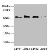 Western blot All lanes: GSDMD antibody at 4µg/ml Lane 1: Jurkat whole cell lysate Lane 2: Hela whole cell lysate Lane 3: A431 whole cell lysate Lane 4: U251 whole cell lysate Secondary Goat polyclonal to rabbit IgG at 1/10000 dilution Predicted ba...