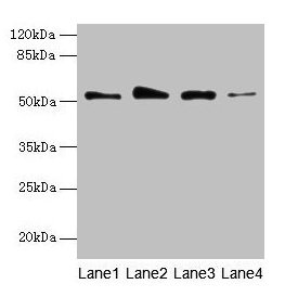 Western blot All lanes: GSDMD antibody at 4µg/ml Lane 1: Jurkat whole cell lysate Lane 2: Hela whole cell lysate Lane 3: A431 whole cell lysate Lane 4: U251 whole cell lysate Secondary Goat polyclonal to rabbit IgG at 1/10000 dilution Predicted ba...