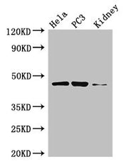 Western Blot Positive WB detected in: Hela whole cell lysate, PC-3 whole cell lysate, Mouse kidney tissue All lanes: GSK3B antibody at 3µg/ml Secondary Goat polyclonal to rabbit IgG at 1/50000 dilution Predicted band size: 47, 49 kDa Observed band...