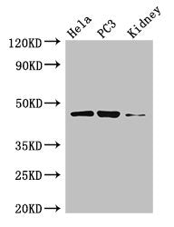 Western Blot Positive WB detected in: Hela whole cell lysate, PC-3 whole cell lysate, Mouse kidney tissue All lanes: GSK3B antibody at 3µg/ml Secondary Goat polyclonal to rabbit IgG at 1/50000 dilution Predicted band size: 47, 49 kDa Observed band...