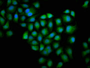 Immunofluorescence staining of Hela cells with CSB-PA009965HA01HU at 1:100, counter-stained with DAPI. The cells were fixed in 4% formaldehyde, permeabilized using 0.2% Triton X-100 and blocked in 10% normal Goat Serum. The cells were then incubat...