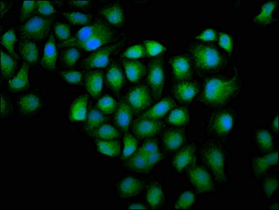 Immunofluorescence staining of Hela cells with CSB-PA009965HA01HU at 1:100, counter-stained with DAPI. The cells were fixed in 4% formaldehyde, permeabilized using 0.2% Triton X-100 and blocked in 10% normal Goat Serum. The cells were then incubat...
