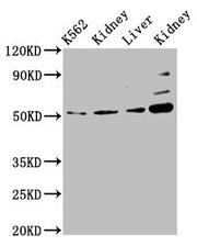 Western Blot Positive WB detected in: K562 whole cell lysate, Rat kidney tissue, Mouse liver tissue, Mouse kidney tissue All lanes: GSS antibody at 5.1µg/ml Secondary Goat polyclonal to rabbit IgG at 1/50000 dilution Predicted band size: 53, 41 kD...