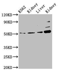 Western Blot Positive WB detected in: K562 whole cell lysate, Rat kidney tissue, Mouse liver tissue, Mouse kidney tissue All lanes: GSS antibody at 5.1µg/ml Secondary Goat polyclonal to rabbit IgG at 1/50000 dilution Predicted band size: 53, 41 kD...