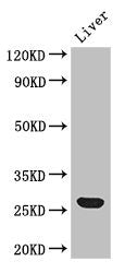 Western Blot Positive WB detected in: Mouse liver tissue All lanes: Gsta1 antibody at 2.7ug/ml Secondary Goat polyclonal to rabbit IgG at 1/50000 dilution Predicted band size: 26 kDa Observed band size: 26 kDa