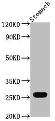 Western Blot Positive WB detected in: Mouse stomach tissue All lanes: Gsta1 antibody at 1:2000 Secondary Goat polyclonal to rabbit IgG at 1/50000 dilution Predicted band size: 26 kDa Observed band size: 26 kDa