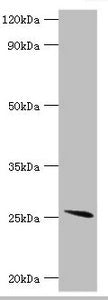 Western blot All lanes: Glutathione S-transferase A2 antibody at 4ug/ml + Mouse liver tissue Secondary Goat polyclonal to rabbit IgG at 1/10000 dilution Predicted band size: 26 kDa Observed band size: 26 kDa