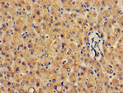 Immunohistochemistry of paraffin-embedded human liver tissue using CSB-PA009973HA01HU at dilution of 1:100