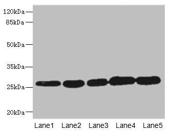 Western blot All lanes: GSTK1 antibody at 0.51µg/ml Lane 1: MCF-7 whole cell lysate Lane 2: K562 whole cell lysate Lane 3: Hela whole cell lysate Lane 4: HepG2 whole cell lysate Lane 5: Raji whole cell lysate Secondary Goat polyclonal to rabbit Ig...