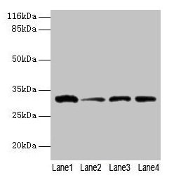 Western blot All lanes: GSTK1 antibody at 2µg/ml Lane 1: 293T whole cell lysate Lane 2: Hela whole cell lysate Lane 3: A431 whole cell lysate Lane 4: COLO205 whole cell lysate Secondary Goat polyclonal to rabbit IgG at 1/10000 dilution Predicted b...