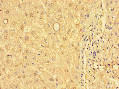 Immunohistochemistry of paraffin-embedded human liver tissue using CSB-PA009979LA01HU at dilution of 1:100