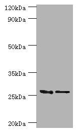 Western blot All lanes: GSTM4 antibody at 10ug/ml Lane 1: Rat lung tissue Lane 2: MCF-7 whole cell lysate Secondary Goat polyclonal to rabbit IgG at 1/10000 dilution Predicted band size: 26, 23, 19 kDa Observed band size: 26 kDa