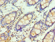 Immunohistochemistry of paraffin-embedded human colon tissue using CSB-PA009984ESR2HU at dilution of 1:100