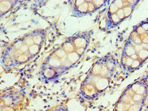 Immunohistochemistry of paraffin-embedded human colon tissue using CSB-PA009984ESR2HU at dilution of 1:100