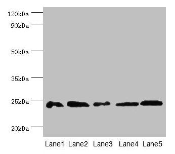 Western blot All lanes: Gstp1 antibody at 2µg/ml Lane 1: Mouse kidney tissue Lane 2: Jurkat whole cell lysate Lane 3: K562 whole cell lysate Lane 4: 293T whole cell lysate Lane 5: Hela whole cell lysate Secondary Goat polyclonal to rabbit IgG at 1...