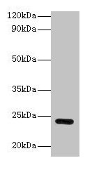 Western blot All lanes: Gstp1 antibody at 2µg/ml + Hela whole cell lysate Secondary Goat polyclonal to rabbit IgG at 1/10000 dilution Predicted band size: 24 kDa Observed band size: 24 kDa