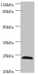 Western blot All lanes: GSTZ1 antibody at 0.41ug/ml + Mouse liver tissue Secondary Goat polyclonal to rabbit IgG at 1/10000 dilution Predicted band size: 25, 18, 20 kDa Observed band size: 25 kDa