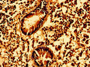 Immunohistochemistry of paraffin-embedded human appendix tissue using CSB-PA009995LA01HU at dilution of 1:100