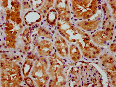 IHC image of CSB-PA009996LA01HU diluted at 1:400 and staining in paraffin-embedded human kidney tissue performed on a Leica BondTM system. After dewaxing and hydration, antigen retrieval was mediated by high pressure in a citrate buffer (pH 6.0)....