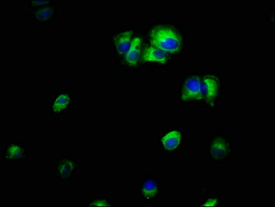 Immunofluorescence staining of MCF-7 cells with CSB-PA00999A0Rb at 1:66, counter-stained with DAPI. The cells were fixed in 4% formaldehyde, permeabilized using 0.2% Triton X-100 and blocked in 10% normal Goat Serum. The cells were then incubated...