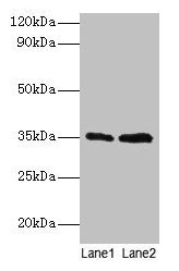 Western blot All lanes: GTF2B antibody at 2µg/ml Lane 1: HepG2 whole cell lysate Lane 2: Hela whole cell lysate Secondary Goat polyclonal to rabbit IgG at 1/15000 dilution Predicted band size: 35 kDa Observed band size: 35 kDa