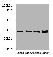 Western blot All lanes: GTF2E2 antibody at 2µg/ml Lane 1: Mouse brain tissue Lane 2: Hela whole cell lysate Lane 3: MCF-7 whole cell lysate Lane 4: PC-3 whole cell lysate Secondary Goat polyclonal to rabbit IgG at 1/10000 dilution Predicted band s...