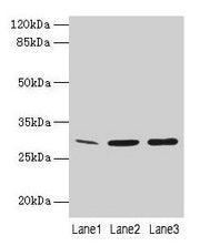 Western Blot All lanes: GTF2F2 antibody at 16µg/ml Lane 1: Mouse spleen tissue Lane 2: K562 whole cell lysate Lane 3: A549 whole cell lysate Secondary Goat polyclonal to rabbit IgG at 1/10000 dilution Predicted band size: 29 kDa Observed band size...
