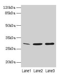 Western Blot All lanes: GTF2F2 antibody at 16µg/ml Lane 1: Mouse spleen tissue Lane 2: K562 whole cell lysate Lane 3: A549 whole cell lysate Secondary Goat polyclonal to rabbit IgG at 1/10000 dilution Predicted band size: 29 kDa Observed band size...