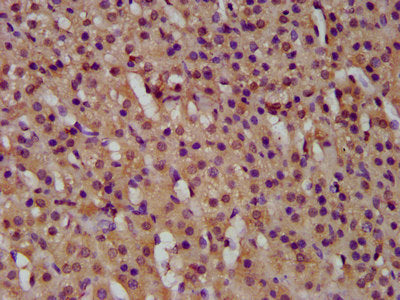 IHC image of CSB-PA010031LA01HU diluted at 1:500 and staining in paraffin-embedded human adrenal gland tissue performed on a Leica BondTM system. After dewaxing and hydration, antigen retrieval was mediated by high pressure in a citrate buffer (pH...