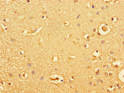 Immunohistochemistry of paraffin-embedded human brain tissue using CSB-PA010053LA01HU at dilution of 1:100