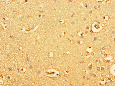 Immunohistochemistry of paraffin-embedded human brain tissue using CSB-PA010053LA01HU at dilution of 1:100