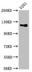 Western Blot Positive WB detected in: U251 whole cell lysate All lanes: GUCY2D antibody at 5.4µg/ml Secondary Goat polyclonal to rabbit IgG at 1/50000 dilution Predicted band size: 121 kDa Observed band size: 121 kDa