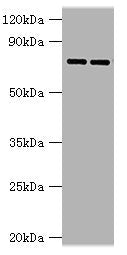 Western blot All lanes: AGUSB antibody at 2ug/ml Lane 1: HL60 whole cell lysate Lane 2: HepG2 whole cell lysate Secondary Goat polyclonal to rabbit IgG at 1/10000 dilution Predicted band size: 75, 70, 59 kDa Observed band size: 75 kDa