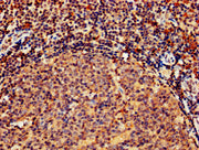 IHC image of CSB-PA010082LA01HU diluted at 1:800 and staining in paraffin-embedded human tonsil tissue performed on a Leica BondTM system. After dewaxing and hydration, antigen retrieval was mediated by high pressure in a citrate buffer (pH 6.0)....
