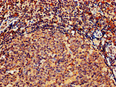 IHC image of CSB-PA010082LA01HU diluted at 1:800 and staining in paraffin-embedded human tonsil tissue performed on a Leica BondTM system. After dewaxing and hydration, antigen retrieval was mediated by high pressure in a citrate buffer (pH 6.0)....