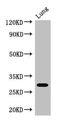 Western Blot Positive WB detected in: Mouse lung tissue All lanes: PSMB5 antibody at 3ug/ml Secondary Goat polyclonal to rabbit IgG at 1/50000 dilution Predicted band size: 29, 22, 18 kDa Observed band size: 29 kDa