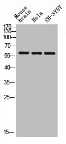 Western blot analysis of mouse-brain HELA SH-SY5Y lysis using Arylsulfatase E antibody.