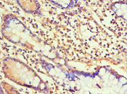 Immunohistochemistry of paraffin-embedded human small intestine tissue using CSB-PA010087ESR1HU at dilution of 1:100