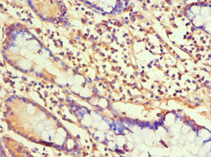 Immunohistochemistry of paraffin-embedded human small intestine tissue using CSB-PA010087ESR1HU at dilution of 1:100