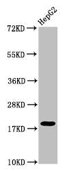 Western Blot Positive WB detected in: HepG2 whole cell lysate All lanes: H1F0 antibody at 1:50 Secondary Goat polyclonal to rabbit IgG at 1/50000 dilution Predicted band size: 21, 20 kDa Observed band size: 21 kDa