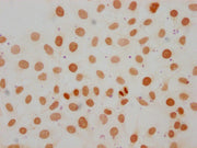 Immunocytochemistry analysis of CSB-PA010087OA107me1HU diluted at 1:50 and staining in Hela cells performed on a Leica BondTM system. The cells were fixed in 4% formaldehyde, permeabilized using 0.2% Triton X-100 and blocked with 10% normal goat s...