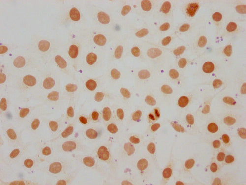 Immunocytochemistry analysis of CSB-PA010087OA107me1HU diluted at 1:50 and staining in Hela cells performed on a Leica BondTM system. The cells were fixed in 4% formaldehyde, permeabilized using 0.2% Triton X-100 and blocked with 10% normal goat s...