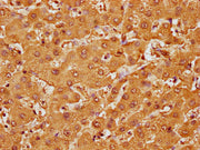 IHC image of CSB-PA010087OA107nme1HU diluted at 1:10 and staining in paraffin-embedded human liver tissue performed on a Leica BondTM system. After dewaxing and hydration, antigen retrieval was mediated by high pressure in a citrate buffer (pH 6.0...