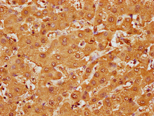 IHC image of CSB-PA010087OA107nme1HU diluted at 1:10 and staining in paraffin-embedded human liver tissue performed on a Leica BondTM system. After dewaxing and hydration, antigen retrieval was mediated by high pressure in a citrate buffer (pH 6.0...