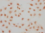 Immunocytochemistry analysis of CSB-PA010087OA11me1HU diluted at 1:15 and staining in Hela cells performed on a Leica BondTM system. The cells were fixed in 4% formaldehyde, permeabilized using 0.2% Triton X-100 and blocked with 10% normal goat se...