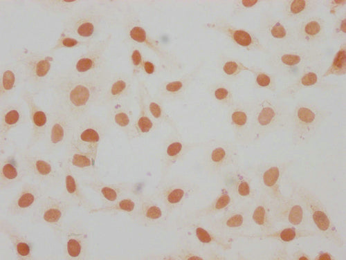 Immunocytochemistry analysis of CSB-PA010087OA11me1HU diluted at 1:15 and staining in Hela cells performed on a Leica BondTM system. The cells were fixed in 4% formaldehyde, permeabilized using 0.2% Triton X-100 and blocked with 10% normal goat se...